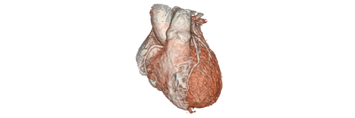 GE Healthcare 3D Heart MRI