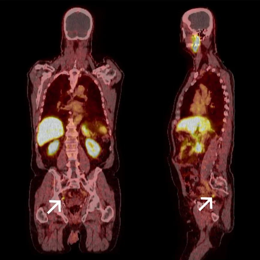United PET-CT Cihazı